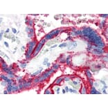IHC - Anti-CD59 Antibody [MEM-43] (A85989)