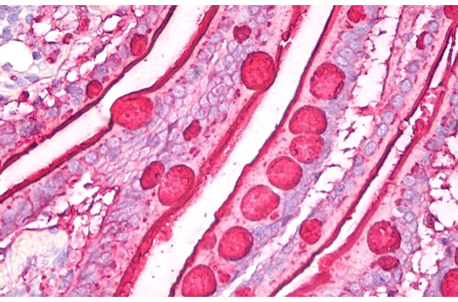 Immunohistochemistry - Anti-Blood Group Lewis b Antibody [2-25LE] (A85997) - Antibodies.com