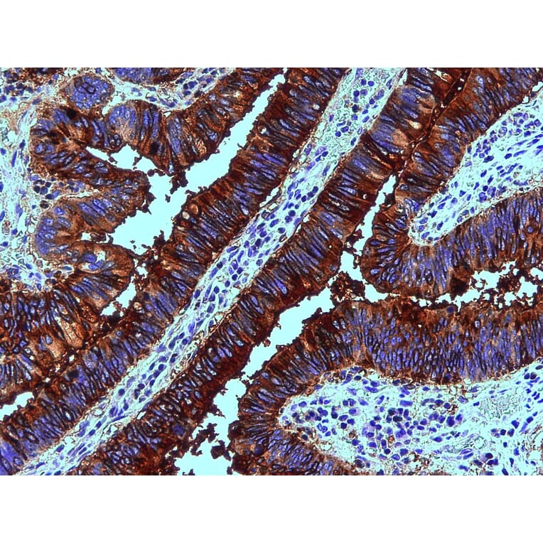 Immunohistochemistry - Anti-Blood Group Lewis b Antibody [2-25LE] (A85996) - Antibodies.com