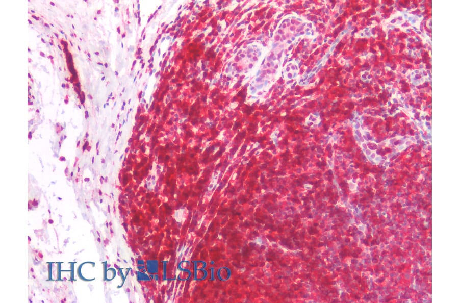 IHC - Anti-CD45RA Antibody [MEM-56] (A86009)