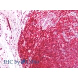 IHC - Anti-CD45RA Antibody [MEM-56] (A86009)