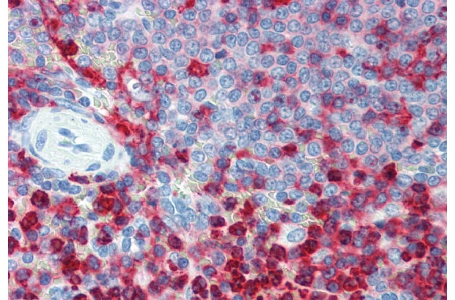Immunohistochemistry - Anti-CD18 Antibody [MEM-48] (A86013) - Antibodies.com