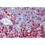 Immunohistochemistry - Anti-CD18 Antibody [MEM-48] (A86013) - Antibodies.com