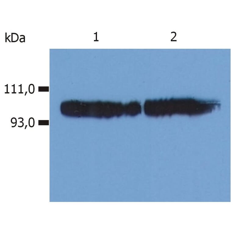 WB - Anti-CD18 Antibody [MEM-48] (A86019)