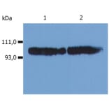 WB - Anti-CD18 Antibody [MEM-48] (A86019)