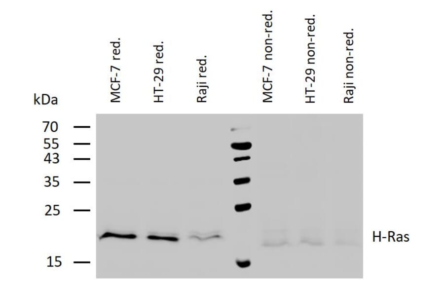 WB - Anti-H-RAS Antibody [H-RAS-03] (A86021)