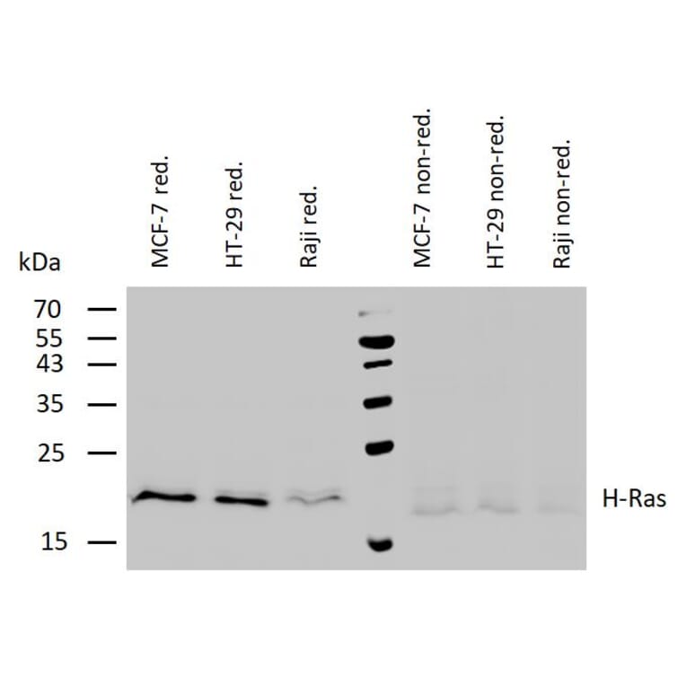 WB - Anti-H-RAS Antibody [H-RAS-03] (A86021)
