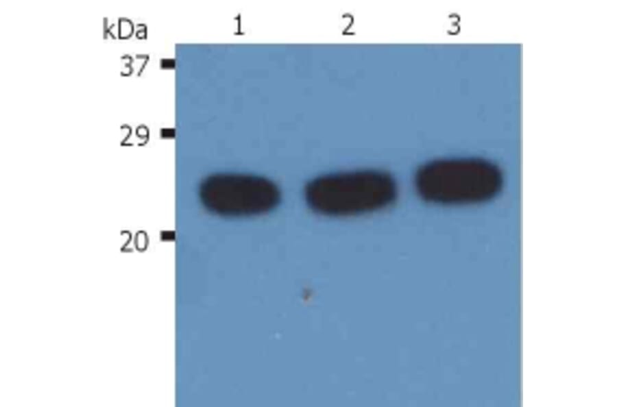 Western Blot - Anti-H-RAS Antibody [H-RAS-03] (A86020) - Antibodies.com