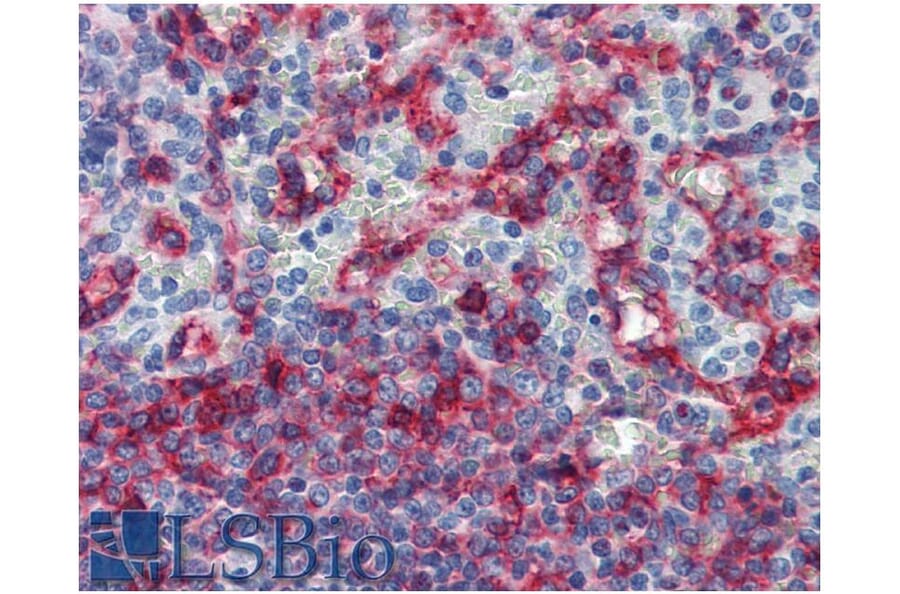 IHC - Anti-HLA E Antibody [MEM-E/06] (A86033)