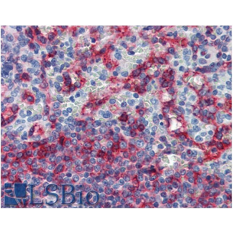 IHC - Anti-HLA E Antibody [MEM-E/06] (A86033)