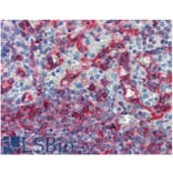 IHC - Anti-HLA E Antibody [MEM-E/06] (A86033)