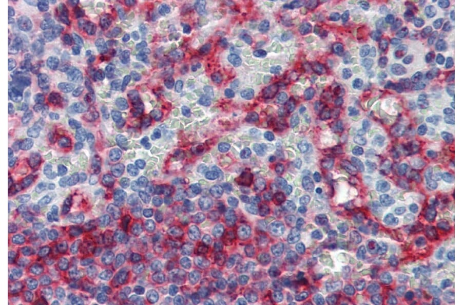 Immunohistochemistry - Anti-HLA E Antibody [MEM-E/06] (A86031) - Antibodies.com