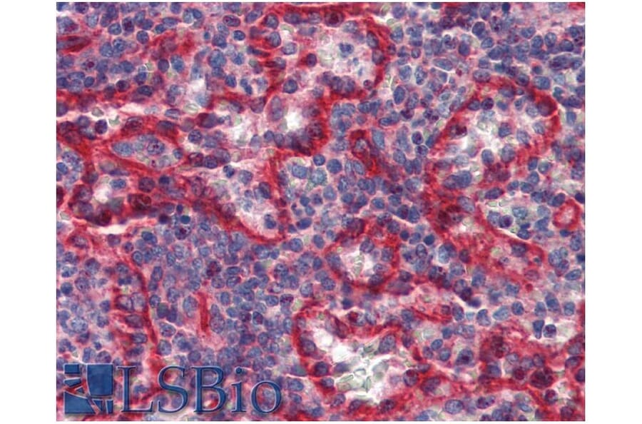 IHC - Anti-HLA E Antibody [MEM-E/07] (A86034)