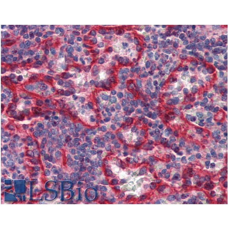 IHC - Anti-HLA E Antibody [MEM-E/07] (A86034)