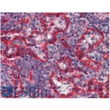 IHC - Anti-HLA E Antibody [MEM-E/07] (A86034)