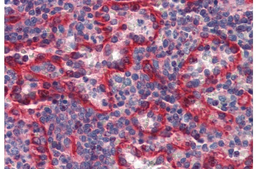Immunohistochemistry - Anti-HLA E Antibody [MEM-E/07] (A86033) - Antibodies.com