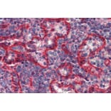 Immunohistochemistry - Anti-HLA E Antibody [MEM-E/07] (A86033) - Antibodies.com