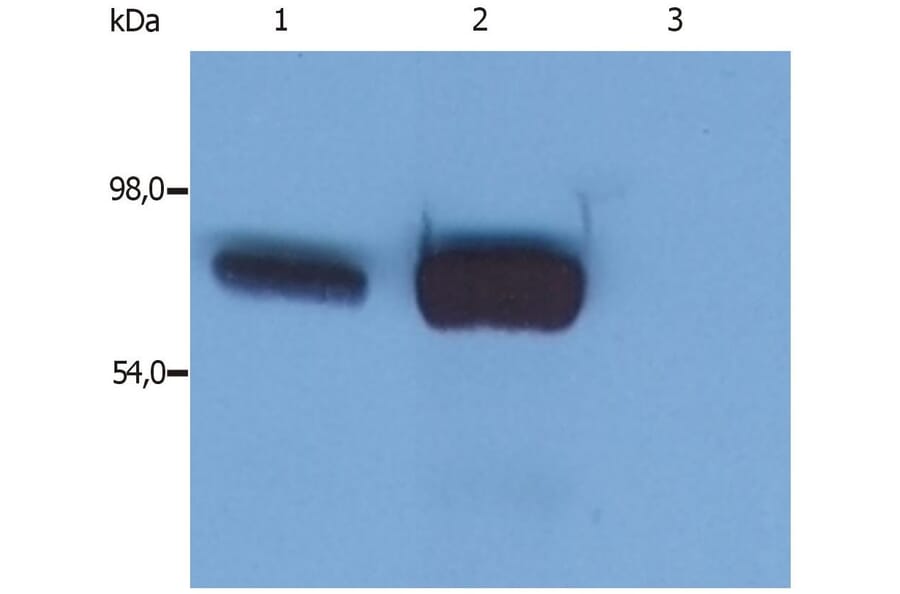 WB - Anti-SLP76 Antibody [SLP-76/03] (A86049)