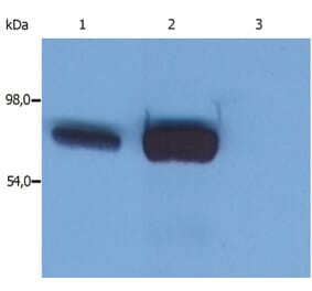 Western Blot - Anti-SLP76 Antibody [SLP-76/03] (A86047) - Antibodies.com