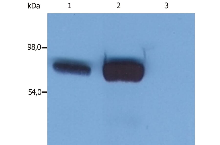 Western Blot - Anti-SLP76 Antibody [SLP-76/03] (A86047) - Antibodies.com