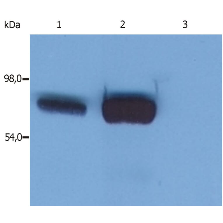 Western Blot - Anti-SLP76 Antibody [SLP-76/03] (A86047) - Antibodies.com