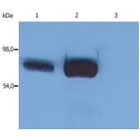 Western Blot - Anti-SLP76 Antibody [SLP-76/03] (A86047) - Antibodies.com