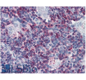 IHC - Anti-SLP76 Antibody (A86050)