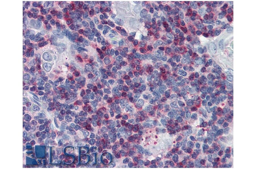 IHC - Anti-SLP76 Antibody (A86050)