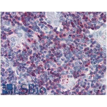 IHC - Anti-SLP76 Antibody (A86050)