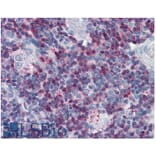IHC - Anti-SLP76 Antibody (A86050)