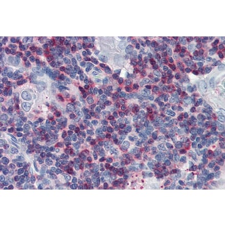 Immunohistochemistry - Anti-SLP76 Antibody (A86049) - Antibodies.com