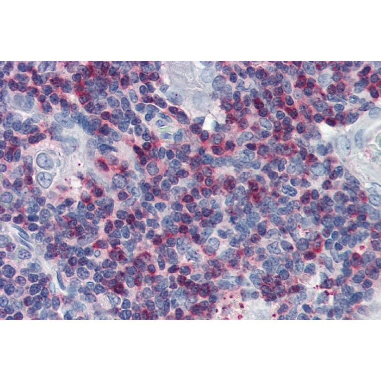 Immunohistochemistry - Anti-SLP76 Antibody (A86049) - Antibodies.com