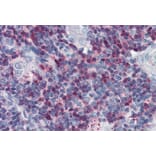 Immunohistochemistry - Anti-SLP76 Antibody (A86049) - Antibodies.com