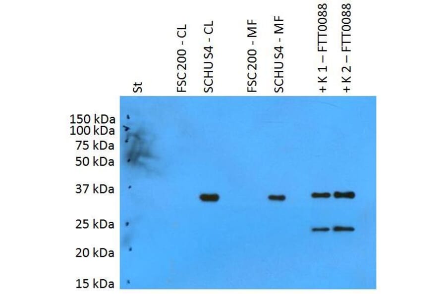 WB - Anti-F. tularensis ssp. tularensis PilT Antibody (A86082)