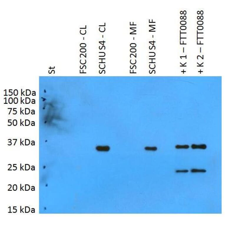 WB - Anti-F. tularensis ssp. tularensis PilT Antibody (A86082)