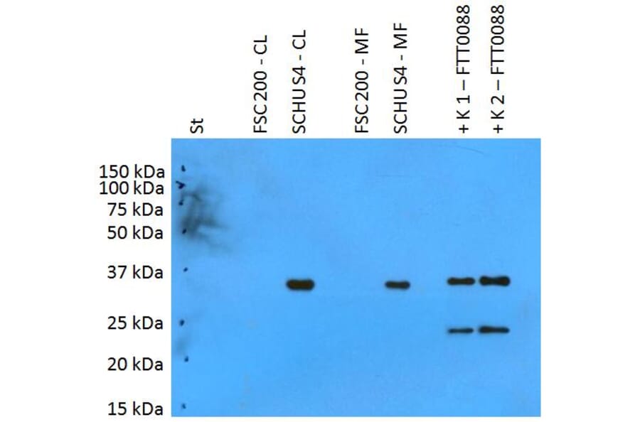 Western Blot - Anti-F. tularensis ssp. tularensis PilT Antibody (A86080) - Antibodies.com