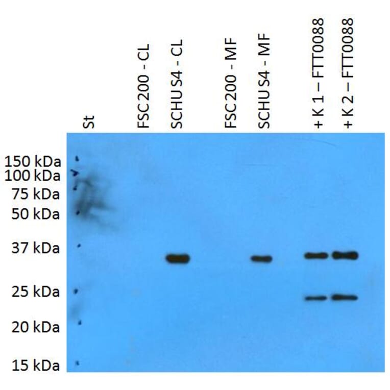 Western Blot - Anti-F. tularensis ssp. tularensis PilT Antibody (A86080) - Antibodies.com