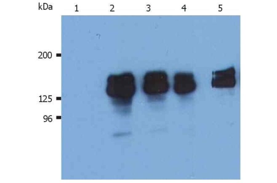 WB - Anti-SHIP-1 Antibody [SHIP-01] (A86106)