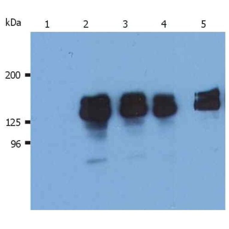 WB - Anti-SHIP-1 Antibody [SHIP-01] (A86106)