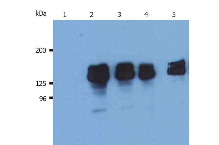 Western Blot - Anti-SHIP1 Antibody [SHIP-01] (A86101) - Antibodies.com