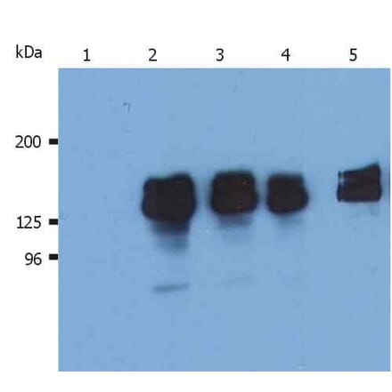 Western Blot - Anti-SHIP1 Antibody [SHIP-02] (A86106) - Antibodies.com