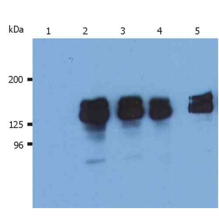 Western Blot - Anti-SHIP1 Antibody [SHIP-02] (A86106) - Antibodies.com