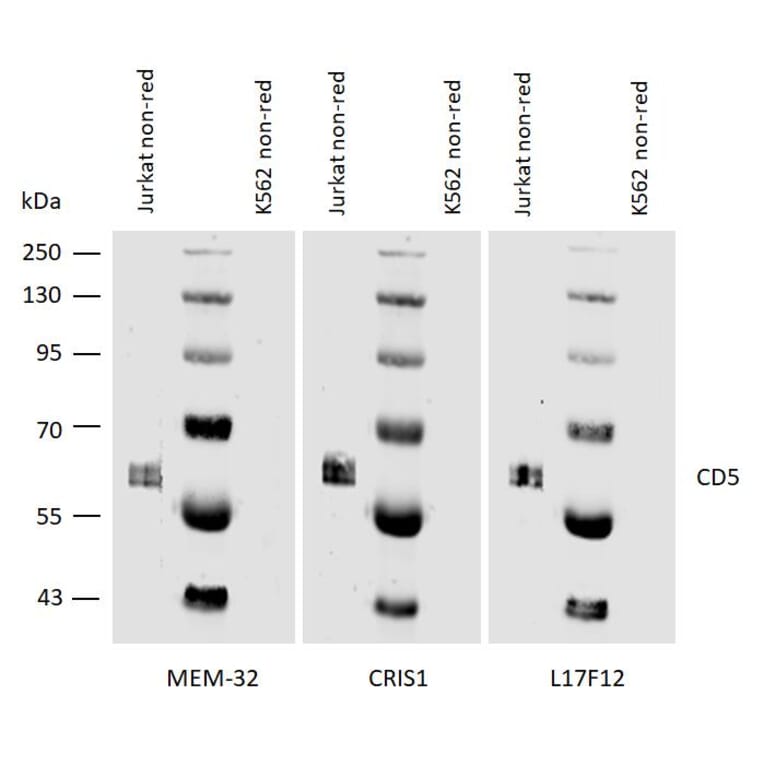 WB - Anti-CD5 Antibody [MEM-32] (A86134)