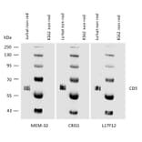 WB - Anti-CD5 Antibody [MEM-32] (A86134)