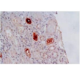 IHC - Anti-HLA G Antibody [MEM-G/2] (A86171)
