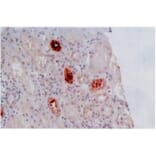 IHC - Anti-HLA G Antibody [MEM-G/2] (A86171)