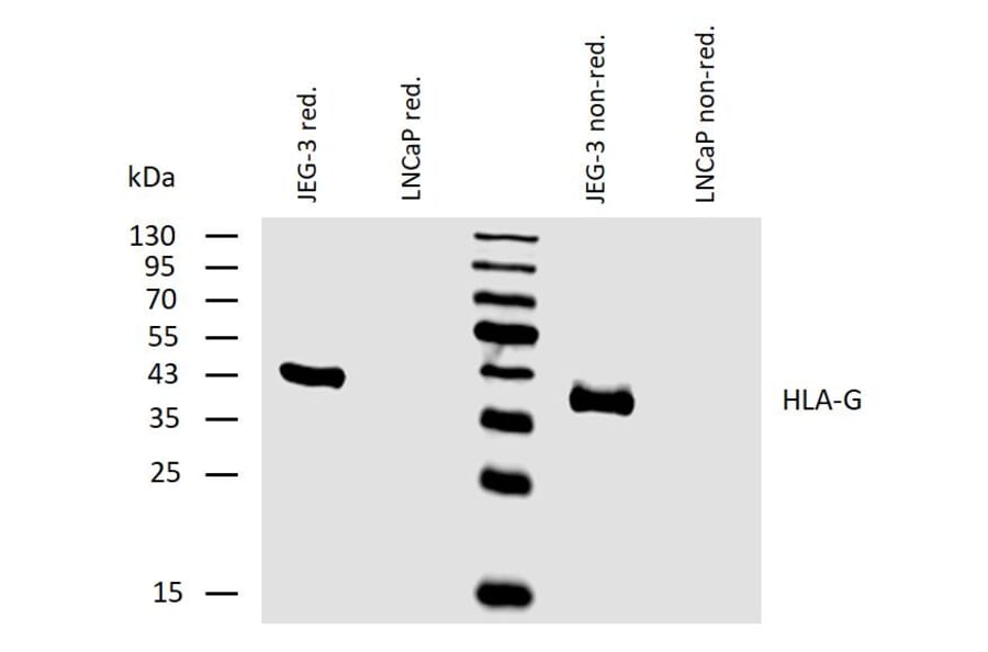 WB - Anti-HLA G Antibody [MEM-G/2] (A86171)