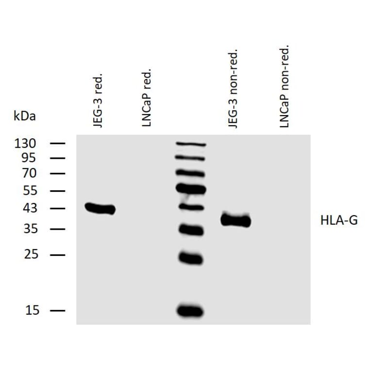 WB - Anti-HLA G Antibody [MEM-G/2] (A86171)