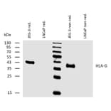 WB - Anti-HLA G Antibody [MEM-G/2] (A86171)