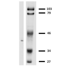 Western Blot - Anti-HLA G Antibody [MEM-G/2] (A86170) - Antibodies.com